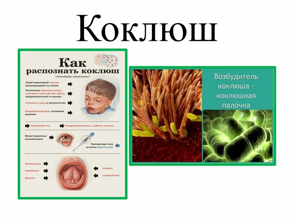 возбудитель коклюша таксономия. возбудители коклюша бордетеллы. какая бактерия вызывает коклюш. возбудитель коклюша палочка. коклюш возбудитель pertussis.