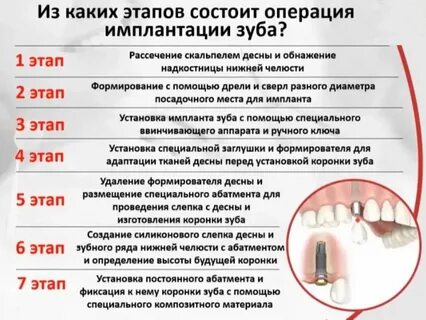Сколько пить антибиотики после имплантации зуба