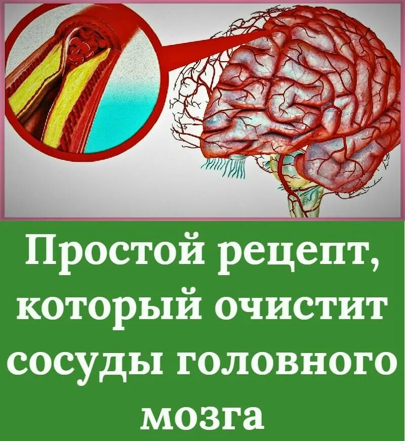 Очистка сосудов головы. Кровеносные сосуды головного мозга. Продукты для очищения сосудов головного мозга. Очищение сосудов головного.