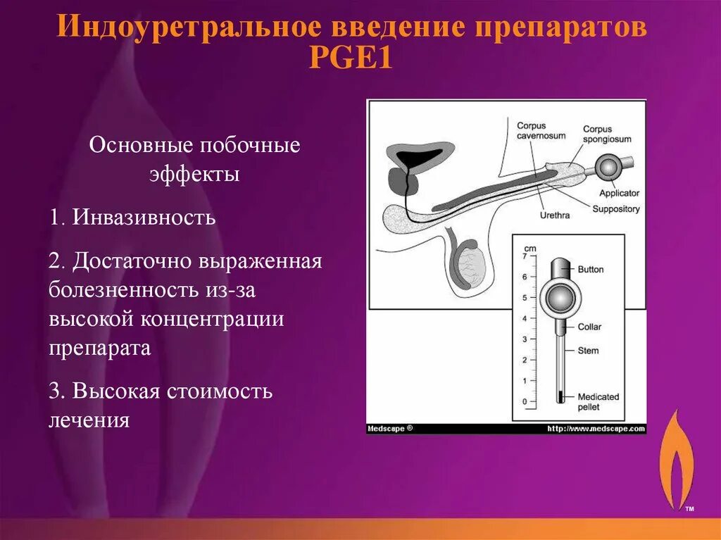 Лечение члена у мужчин. Эректильная дисфункция. Препараты для эректильной дисфункции. Терапия эректильной дисфункции. Таблетки для лечения эректильной дисфункции.