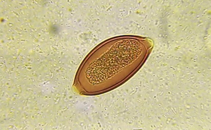 Микроскопия кала яйца гельминтов. Яйца остриц под микроскопом. Острицы в Кале микроскопия. Купить яйца глист