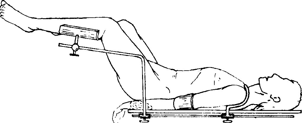 Положение больного на столе. Литотомическое положение / положение Ллойд Дэвис. Литотомическое положение. Положение больного после операции. Положение пациента на операционном столе.