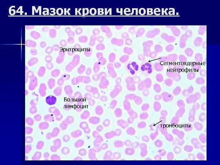 Сегментоядерные 20. Сегментоядерные нейтрофилы гистология. сегментоядерные нейтрофилы в мазке крови.