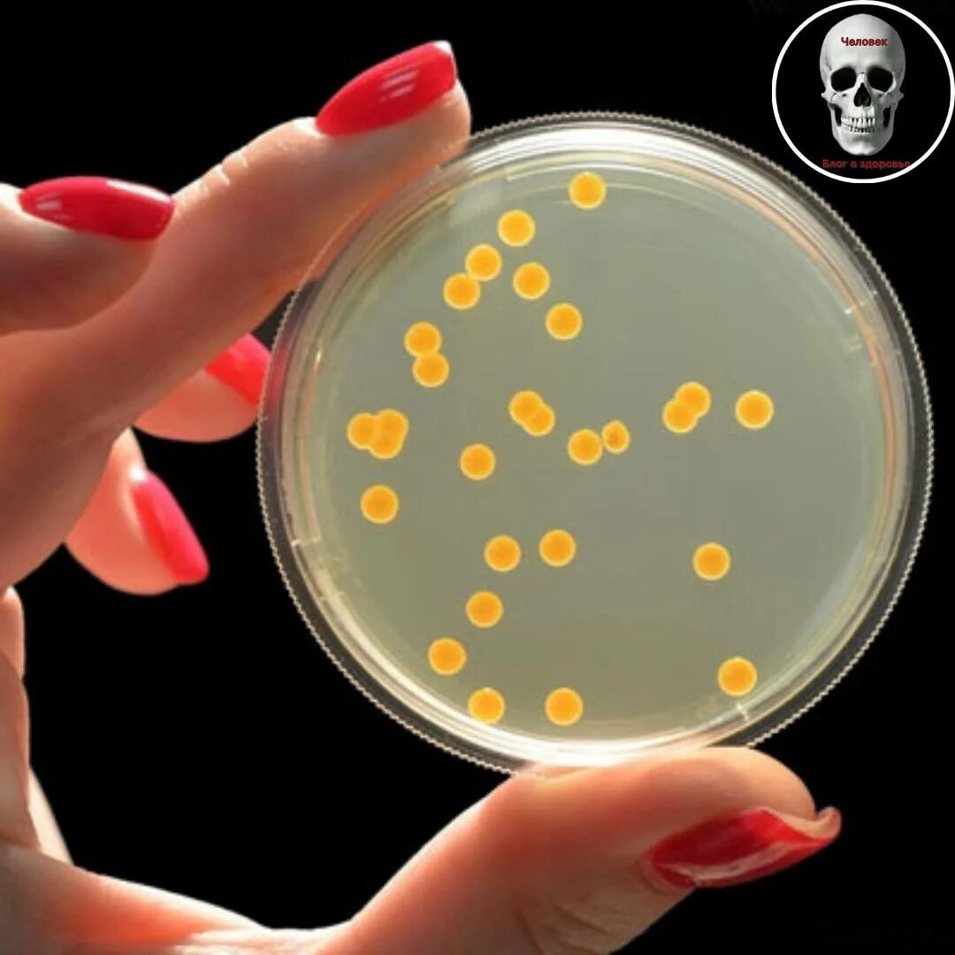 Питательные среды золотистого стафилококка. Staphylococcus aureus на чашке Петри. Золотистый стафилококк на чашке Петри. Стафилококк в чашке Петри. Стафилококк на питательной среде в чашке Петри.