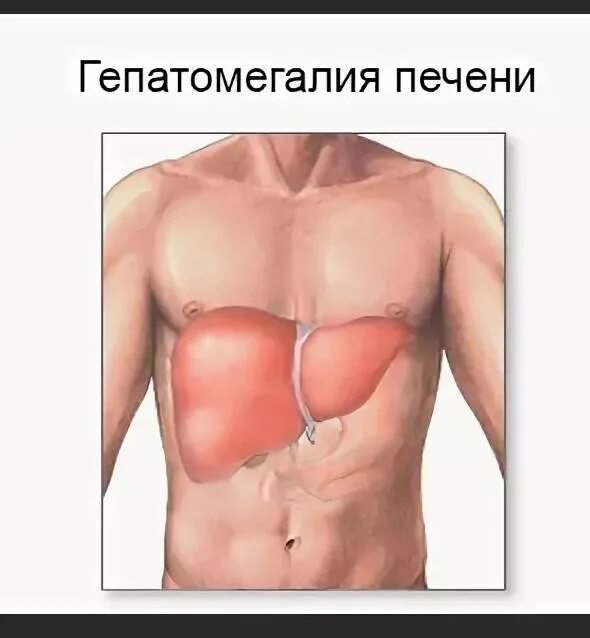 Печень взрослого человека. Гепатомегалия печени. Размер человеческой печени.