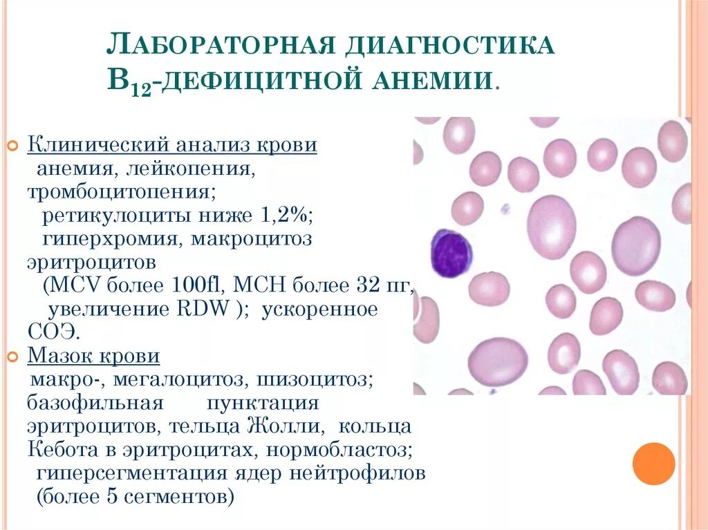 Аллергическая анемия. Лабораторные исследования при б12 дефицитной анемии. Ретикулоциты при в12 дефицитной анемии. Б12 дефицитная анемия анализ крови показатели. В12 анемия клинический анализ крови.