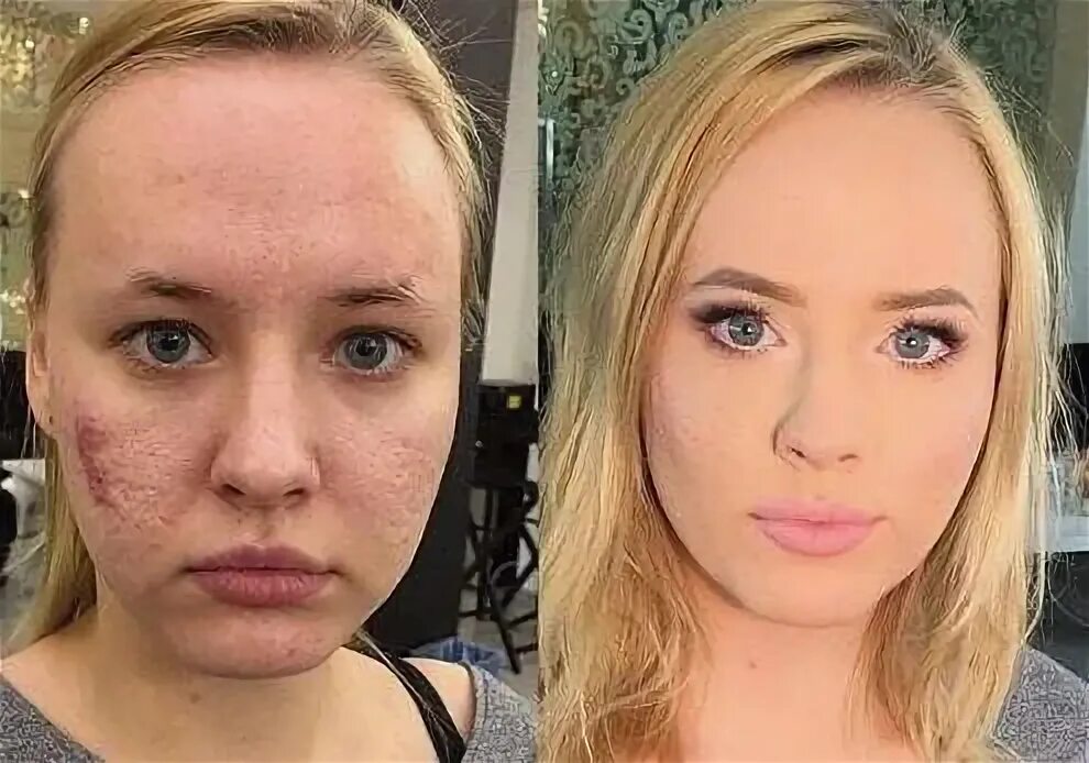 Красавица превратилась в. Девушки без макияжа до и после. Евгения феофилактова после пластики. Два преображения. Девушки без косметики в конче.