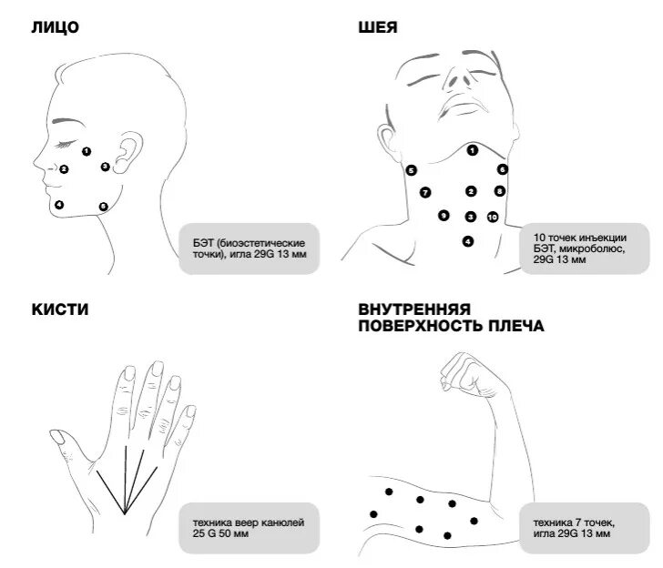 Схема введения препарата профайло. Профайло Profhilo препарат 5 точек. Профайло Profhilo препарат 5 точек техника введения. Схема инъекций профайло. Профайла цена процедуры