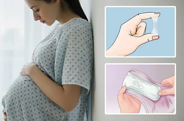 Выделения у беременных на ранних. Прокладка для беременных женщин. Выделения на ранних сроках беременности.