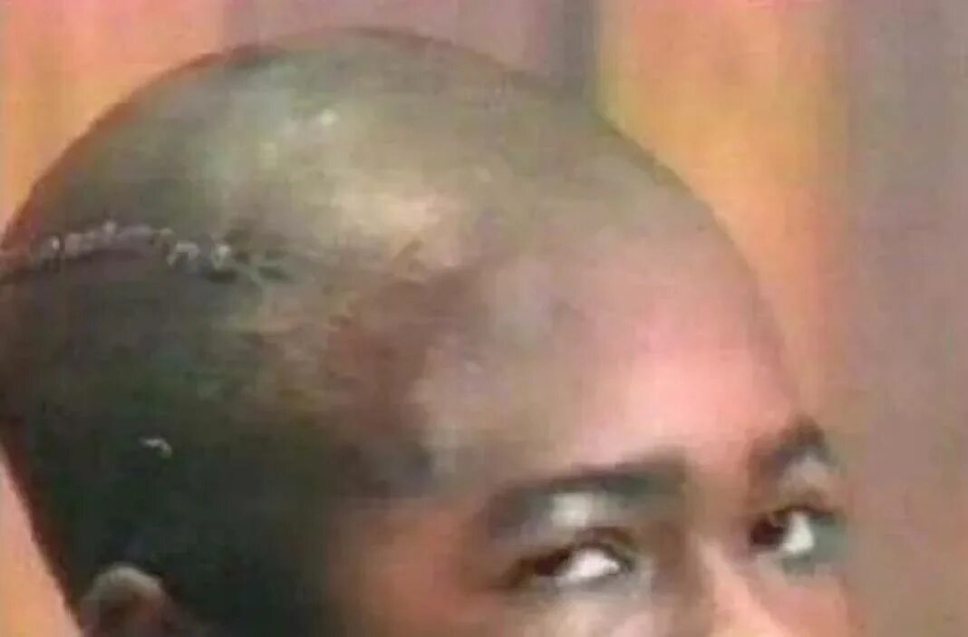 Detached head