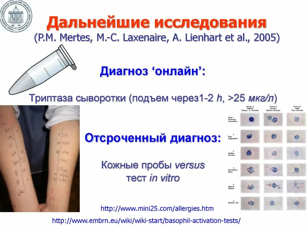 Диагностика 25 января. Диагноз 25. Классификация кожных проб. Л 25 диагноз.