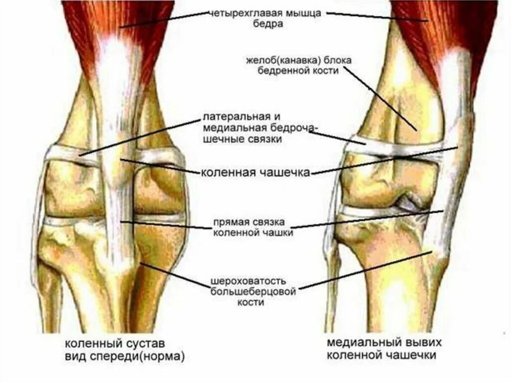 Медиальный мыщелок большеберцовой. Подвывих бедренной кости в коленном суставе. Пателла коленного сустава собаки. Строение колена надколенник. Анатомия коленного сустава собаки.