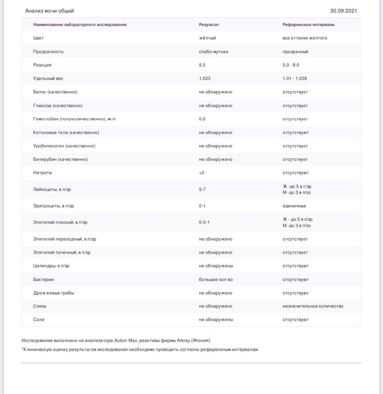 Обнаружение в моче. Обнаружение в моче. Сроки обнаружения наркотических. Обнаружение в моче. Глюкоза в моче показатели.