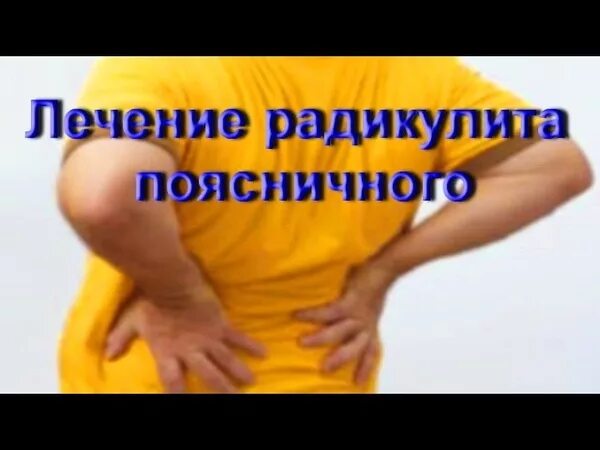 Радикулит лекарства. Радикулит лекарства. Радикулит лечение москва. Медицинское название радикулита. Радикулит лечение москва.