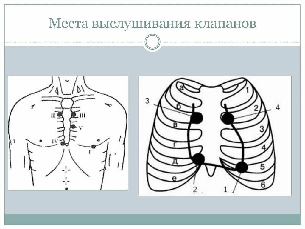 Проекция и аускультация клапанов. Точки проекции клапанов сердца. Места аускультации клапанов сердца. Проекция выслушивания клапанов. Клапаны сердца на грудной клетке