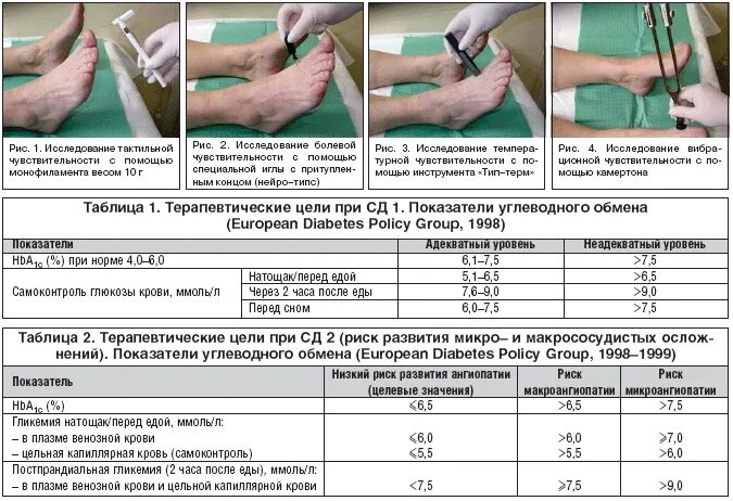Диагностика диабетической полинейропатии нижних конечностей. Препараты при полинейропатии верхних конечностей. Исследование чувствительности при диабетической полинейропатии. Диагноз полинейропатии нижних конечностей. Диабет нейропатия конечностей лечение