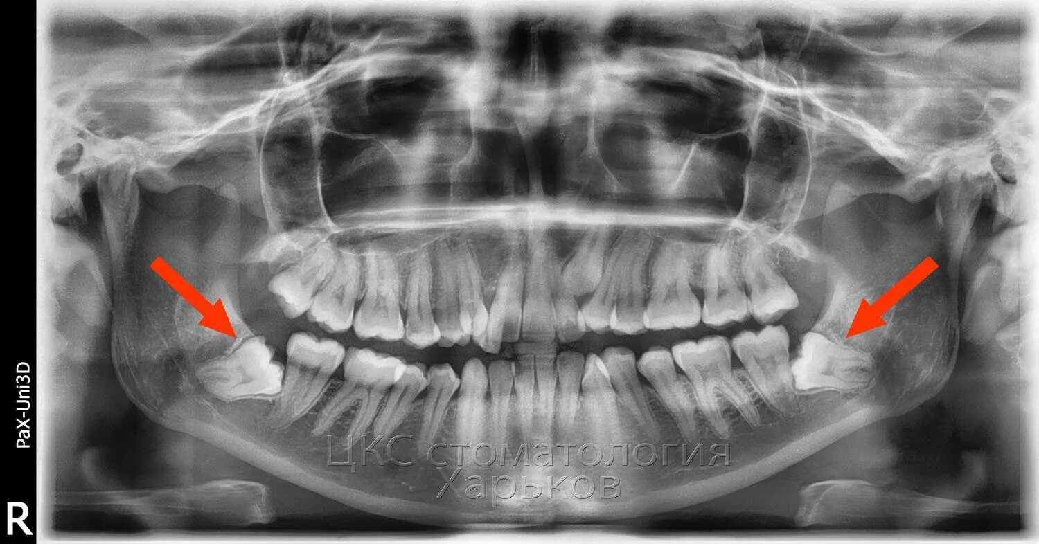 Панорама: Happy Dental, стоматологическая клиника, ул. Ленинская Слобода, 4, Мос