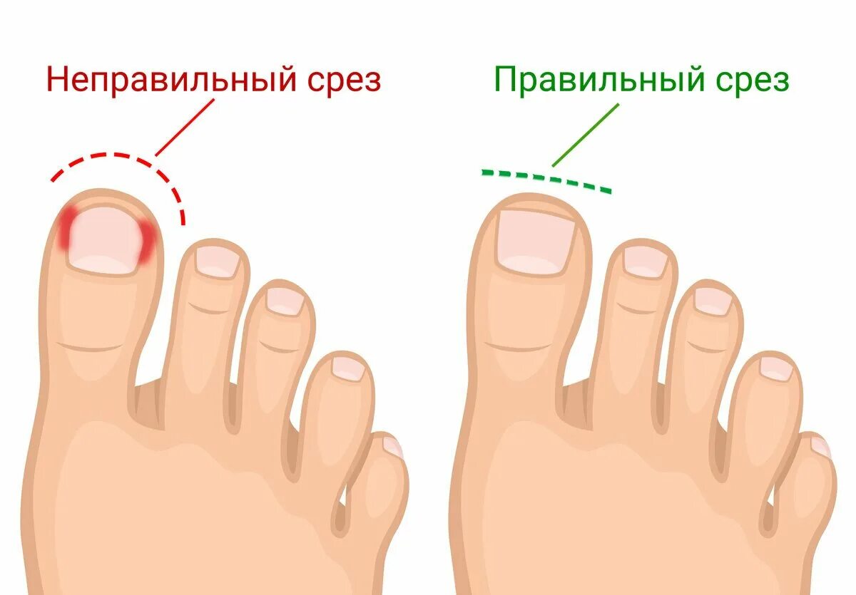 Угол пальца