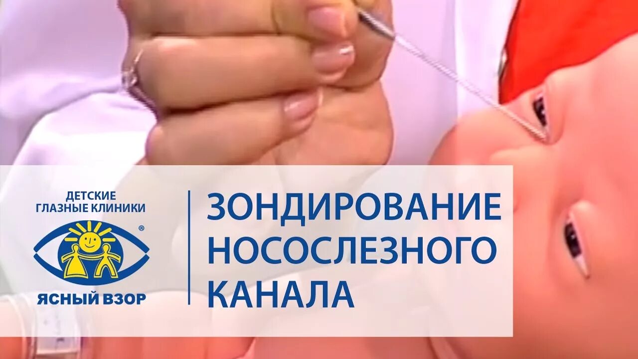 Зондирование слезного канала. Зондирование слезного канала у младенцев. Зондирование носослезного канала у детей. Зондирование слезного канала у новорожденного.