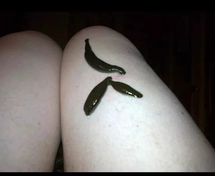 Пиявки можно использовать. Hirudo medicinalis orientalis восточная. Пиявки можно использовать. Пиявка с шипом на хвосте. Пиявки можно использовать.