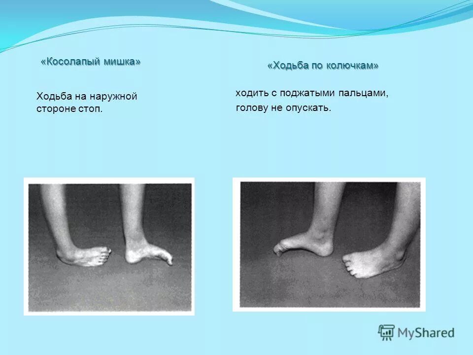 Гимнастика для голеностопного сустава. Ступни ног. Стопа при ходьбе в сторону. Стопа при ходьбе в сторону. Ходьба на носках и пятках.