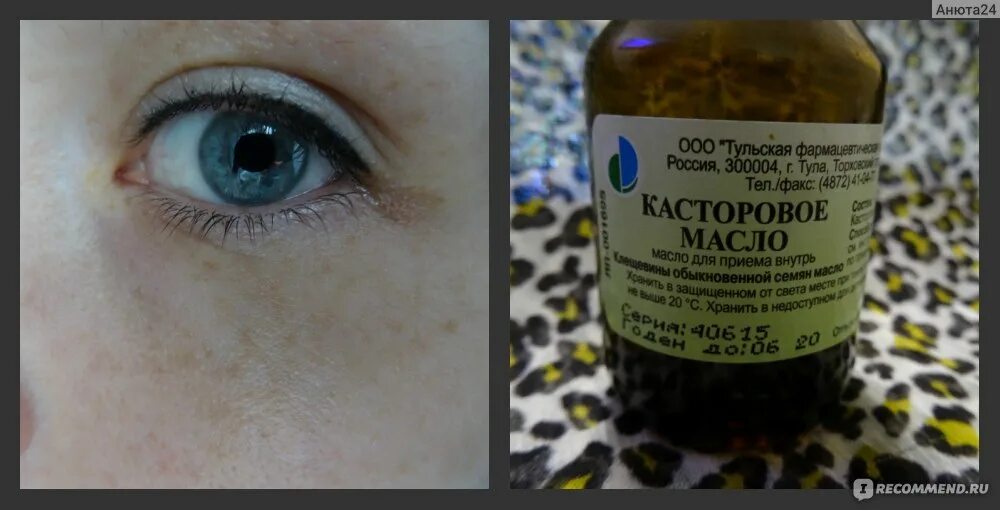 Касторовое масло ( 30 мл фл. Касторовое масло для беременности. Касторка стимуляции. Касторовое масло для стимуляции родов. Касторовое масло для вызывания родов.