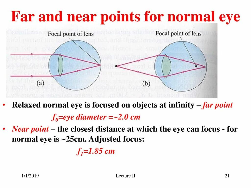 Near & far. Normal points. Accommodation of Eye near far. Far sightedness and near sightedness. The further distance