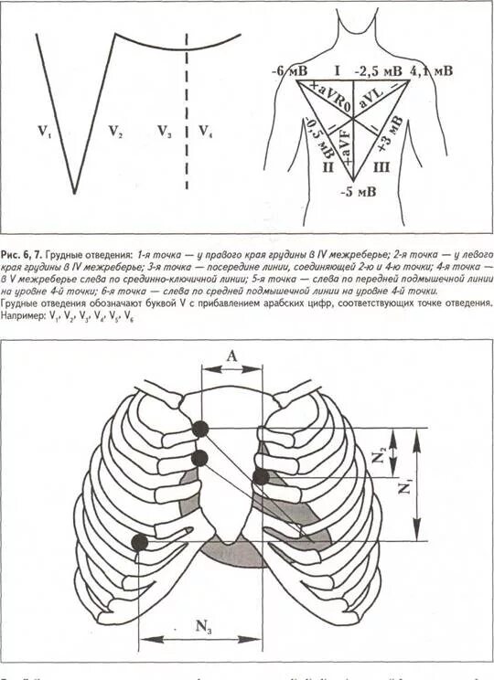 Грудные отведения на ЭКГ электроды. Грудные отведения ЭКГ норма. Грудные электроды для ЭКГ расположение. Отведения ЭКГ грудные отведения. Правые грудные отведения