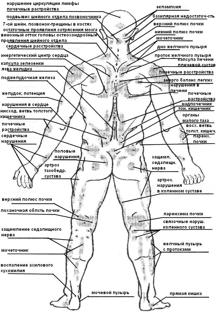 Человек левой стороны какой орган находится. Болевые точки у человека сзади. Анатомия человека внутренние органы сзади со спины. Огулов зоны на теле человека проекционные. Огулов проекционные зоны внутренних органов на теле человека.