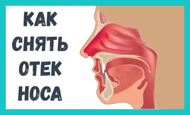 О ЕК слишистой носа. Отек слизистой от капель