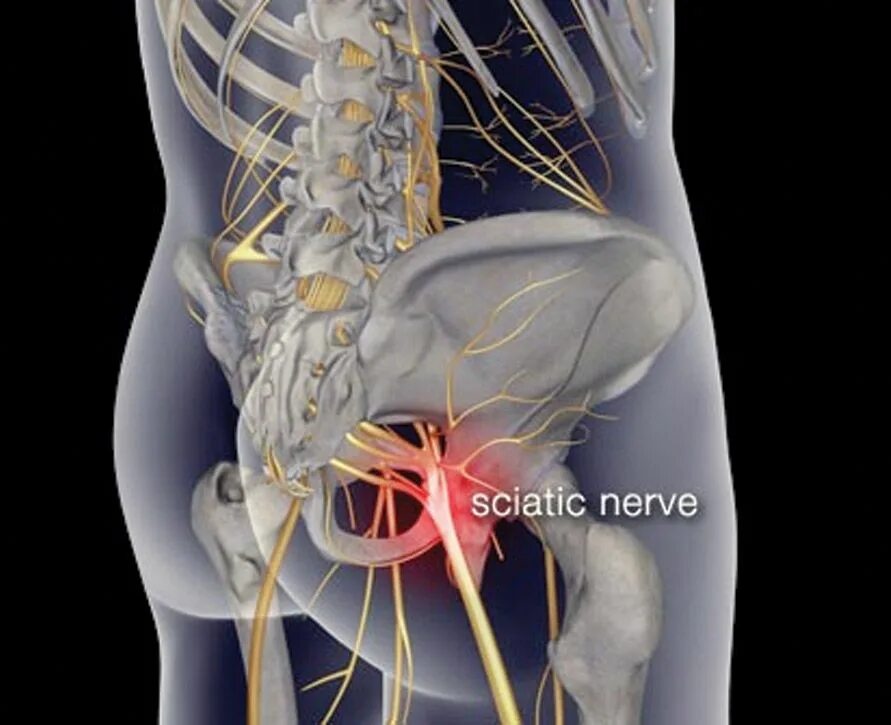 Седалищный нерв анатомия. Седалищный нерв л5 с1. Седалищный нерв (sciatic nerve)? 011. Защемление тазобедренного нерва.