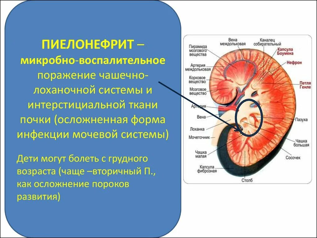 Почка округлой формы