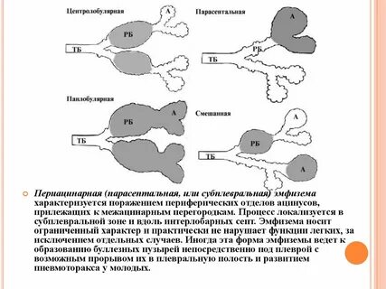 Эмфизема ответы