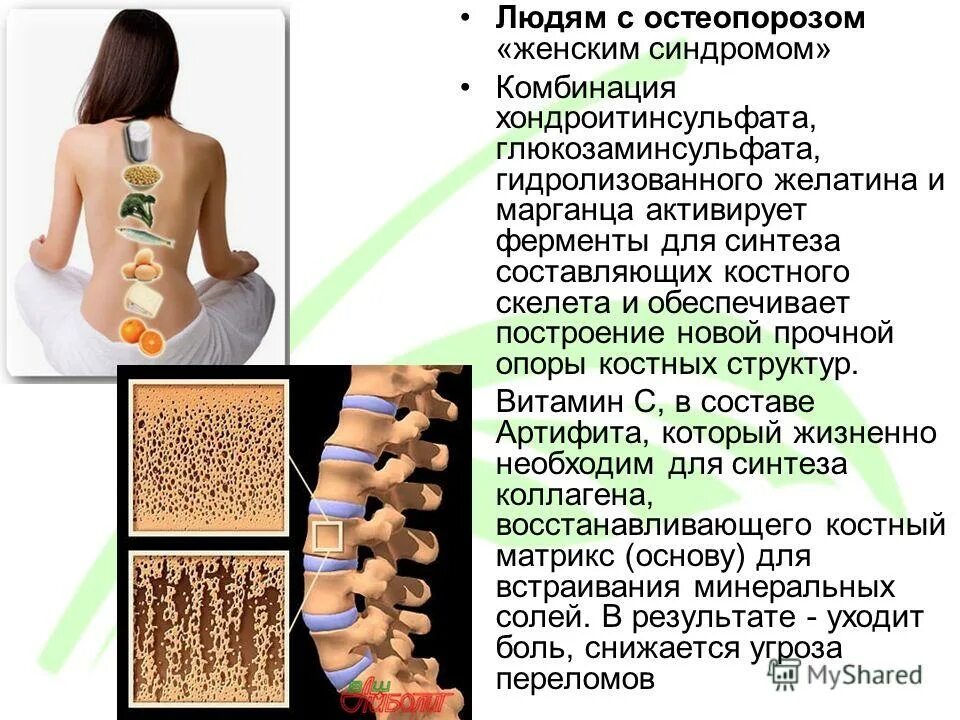 Остеопороз какой врач. Остеопороз какой врач
