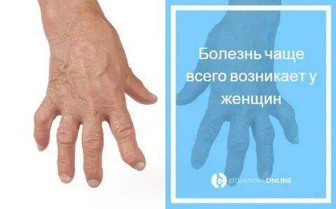 Остеопороз кистей