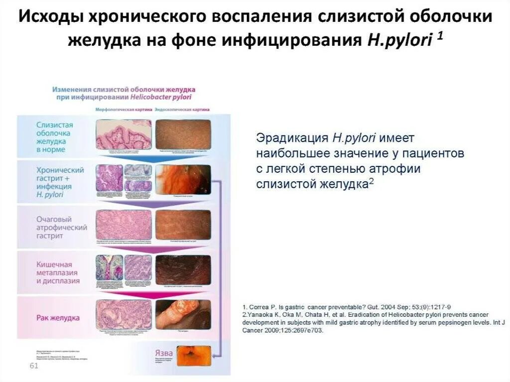 Обсеменение хеликобактера. Обсеменение хеликобактер пилори. заболевания ассоциированные с инфекцией helicobacter pylori. кал при заражении хеликобактер пилори. степени инфицирования хеликобактер.