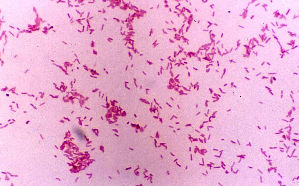 Коклюш бактериальная. Бордетеллы коклюша морфология. Bordetella pertussis микроскопия. Бордетеллы коклюша микроскопия. Бактерия Bordetella pertussis.