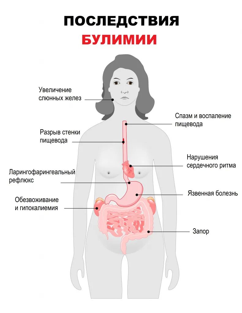 Страдаю булимией