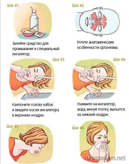 Что делать после промывания носа. Промывание носа солёной водой при синусите. Промывание носа схема пазух. Гайморит промыть пазухи носа. Гайморовы пазухи промывание носа.