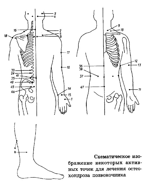 Точечный массаж спины. Акупунктурные точки при боли в пояснице. Акупунктурные точки при шейном остеохондрозе. Точечный массаж спины схема. Точечный массаж спины болевые точки.