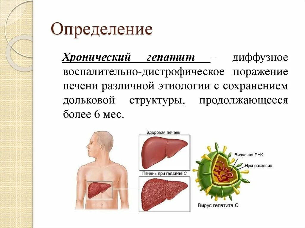 Хронический диффузный печень. Хронический вирусный гепатит с. Острый и хронический гепатит.