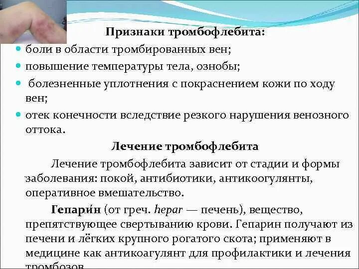 Признаки тромбоза симптомы. Причины тромбов симптомы