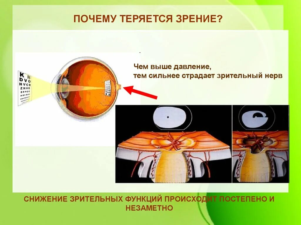 Почему пропадает зрение