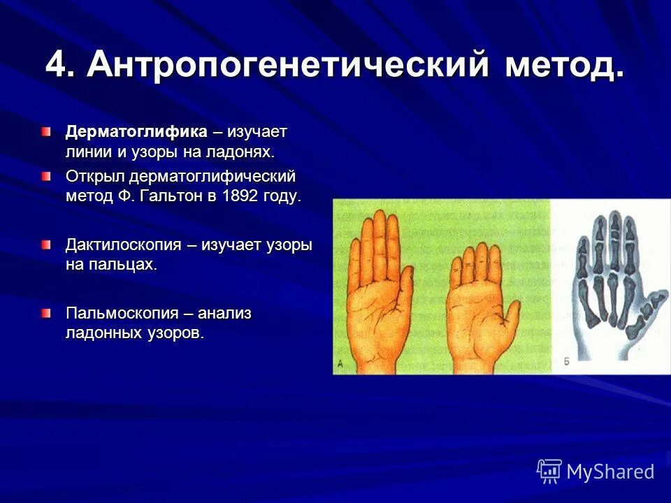 дерматоглифика метод генетики. дерматоглифический метод изучения. метод дерматоглифики в генетике. метод дерматоглифики синдром дауна. трирадиус дерматоглифика.