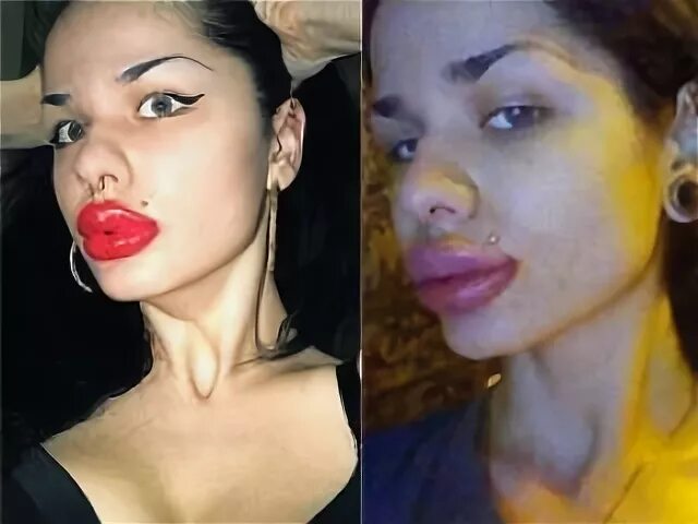 Увеличенные губы красивые. Зачем девушки накачивают губы. Перекаченные губы у девушки. Светлана давыдова дом 2 губы. Накачала губы до и после.