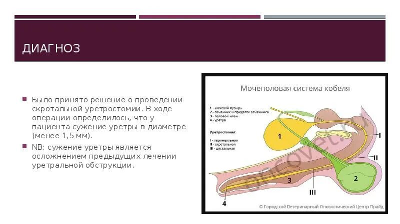 Скротальная уретростомия. Стриктура уретры операция. Осложнения стриктуры уретры. Уретра у мужчин инфекция