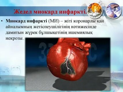 Миокард презентация