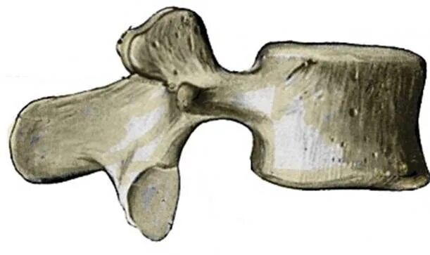 Позвонок форма костей. Форма косточки.