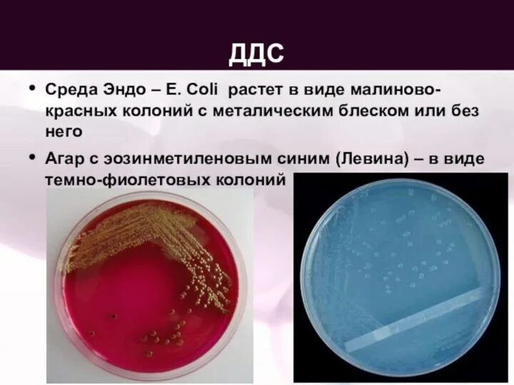 Питательные среды Эндо Левина Плоскирева. Кишечная палочка на среде Плоскирева. Среда Эндо микробиология состав. Кишечная палочка на среде Эндо. Среда для кишечной палочки