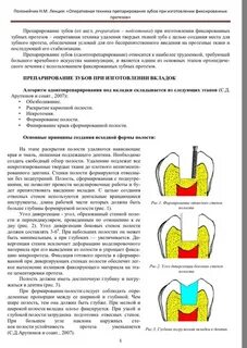 Методы препарирования твердых тканей зуба